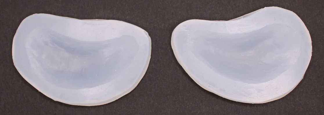 Jess FX Bondo Moulds - under eye swellings - Image 2