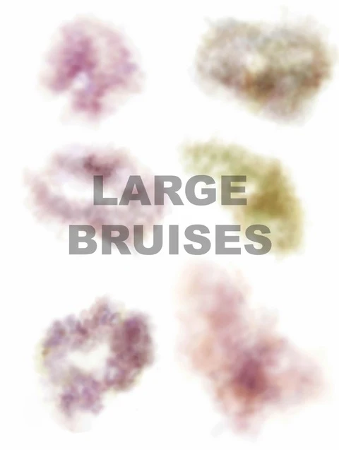 Mad Inc - Large Bruises