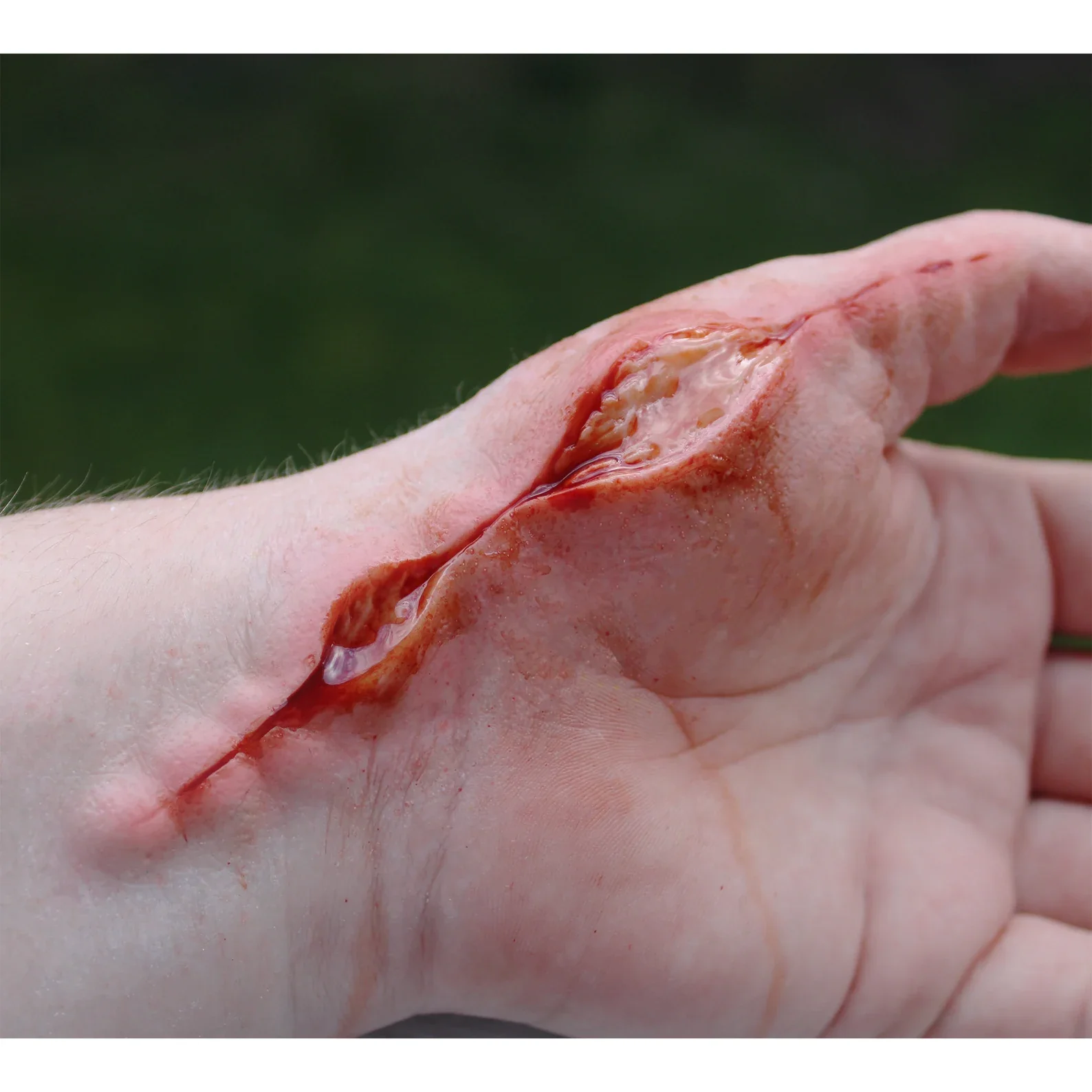 Jess FX Prosthetic Appliances - Burst Sutures
