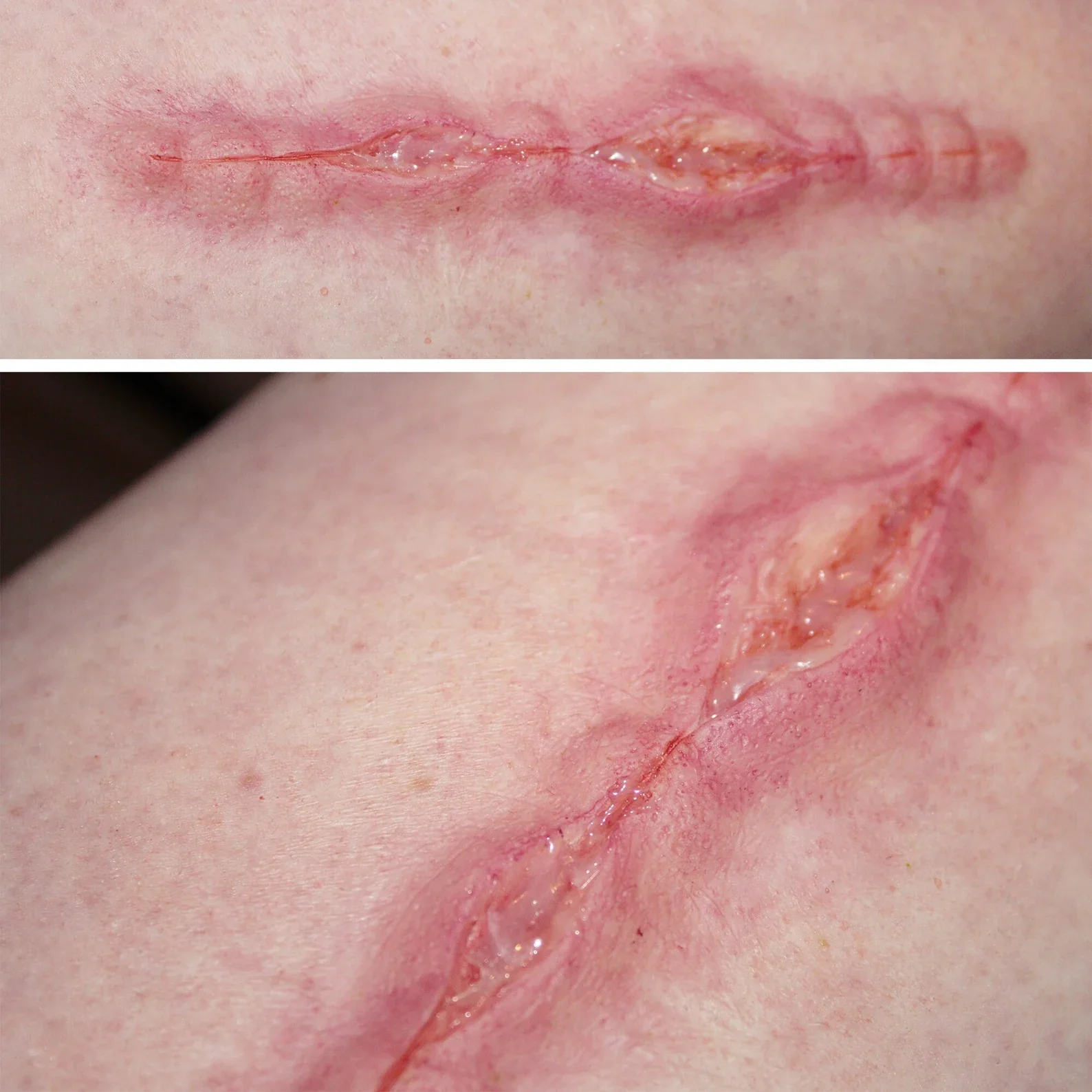 Jess FX Prosthetic Appliances - Burst Sutures - Image 2
