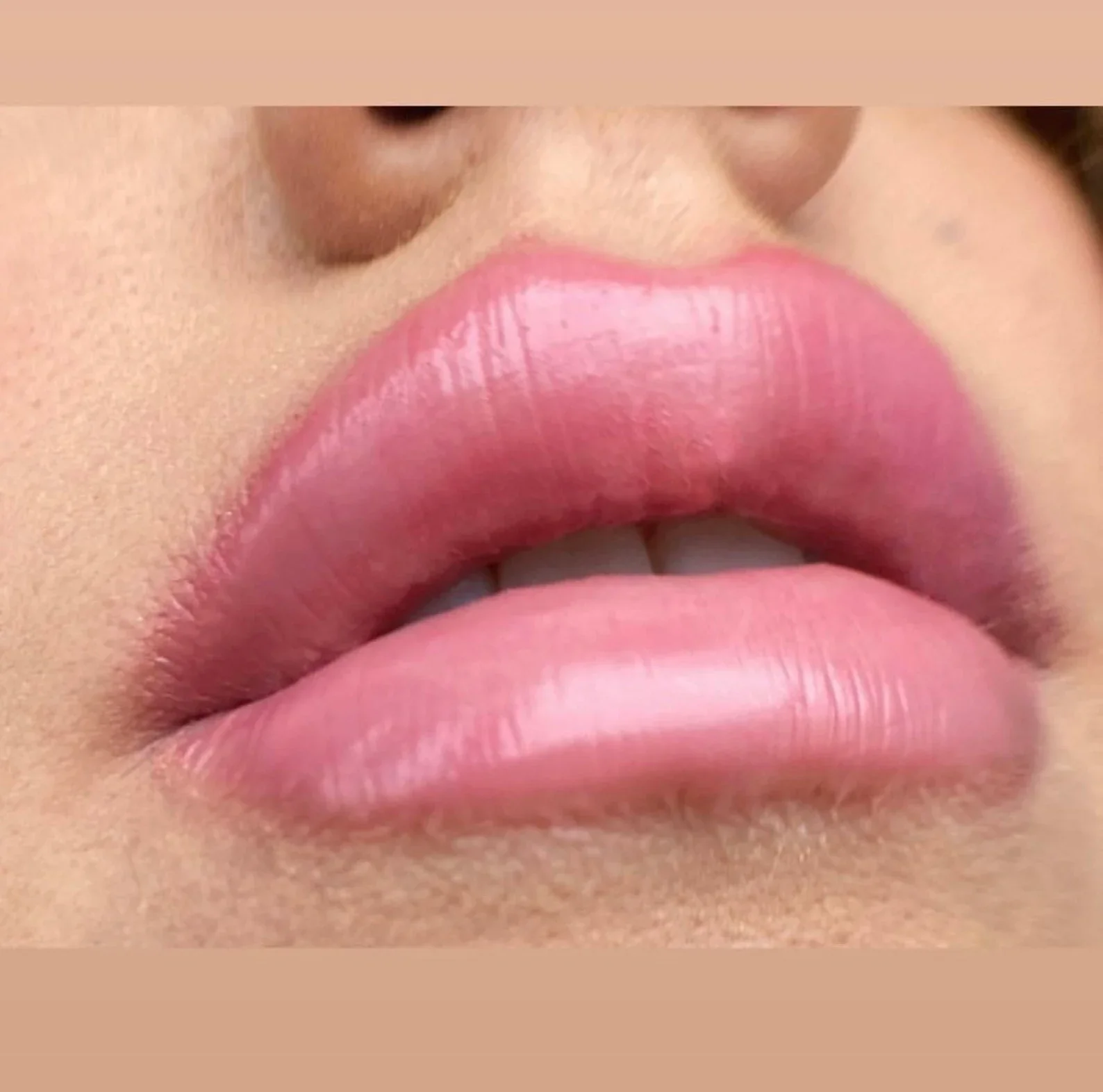 Jess FX Prosthetic Appliances - Enhanced Lips