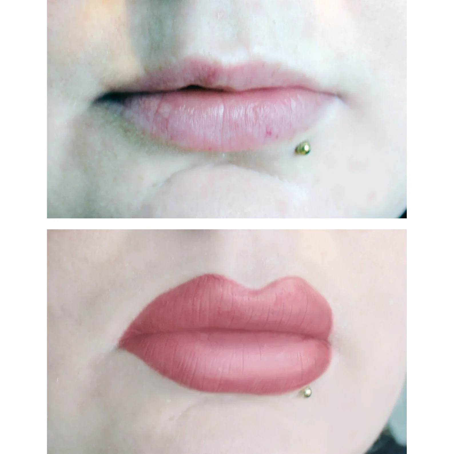 Jess FX Prosthetic Appliances - Enhanced Lips - Image 2