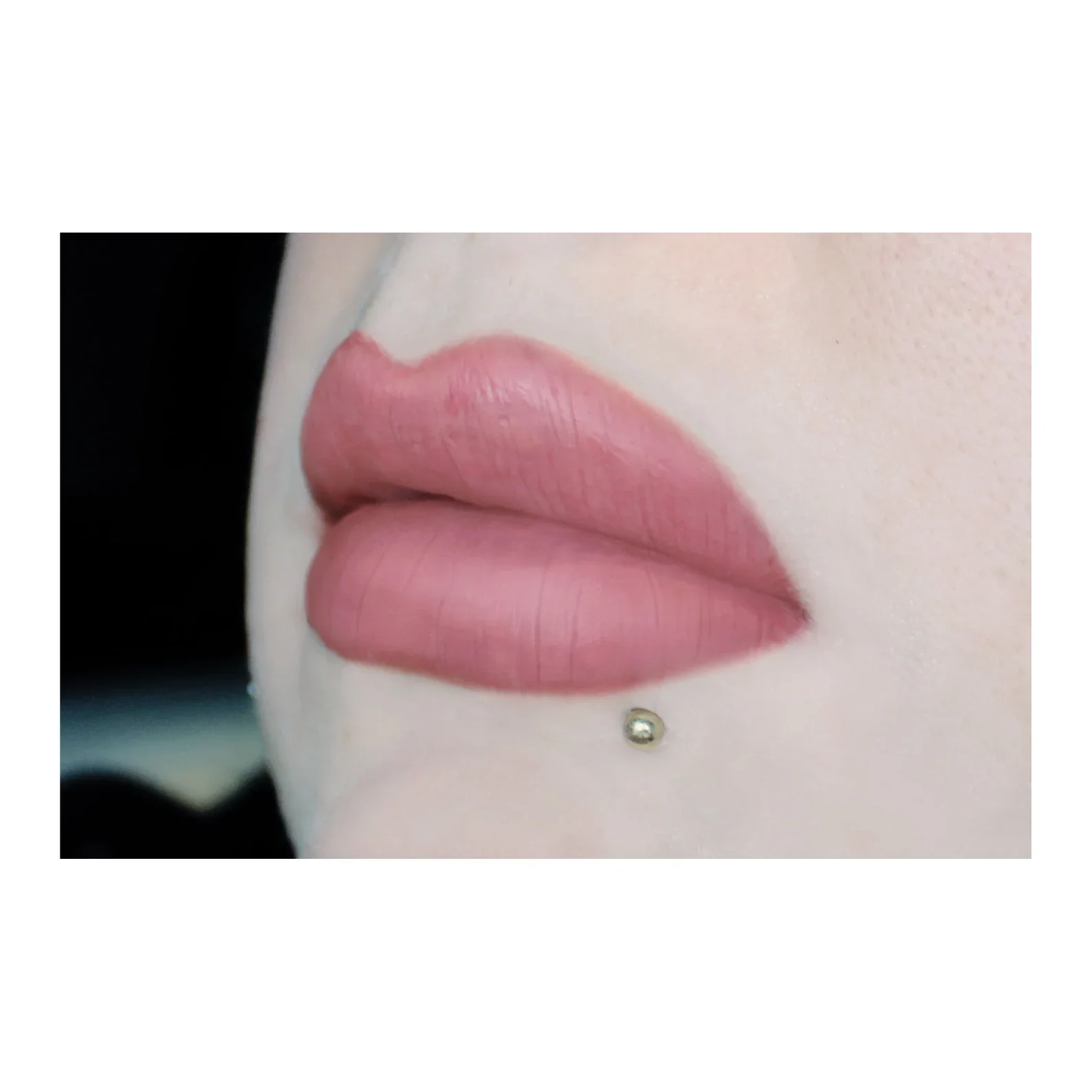 Jess FX Prosthetic Appliances - Enhanced Lips - Image 3