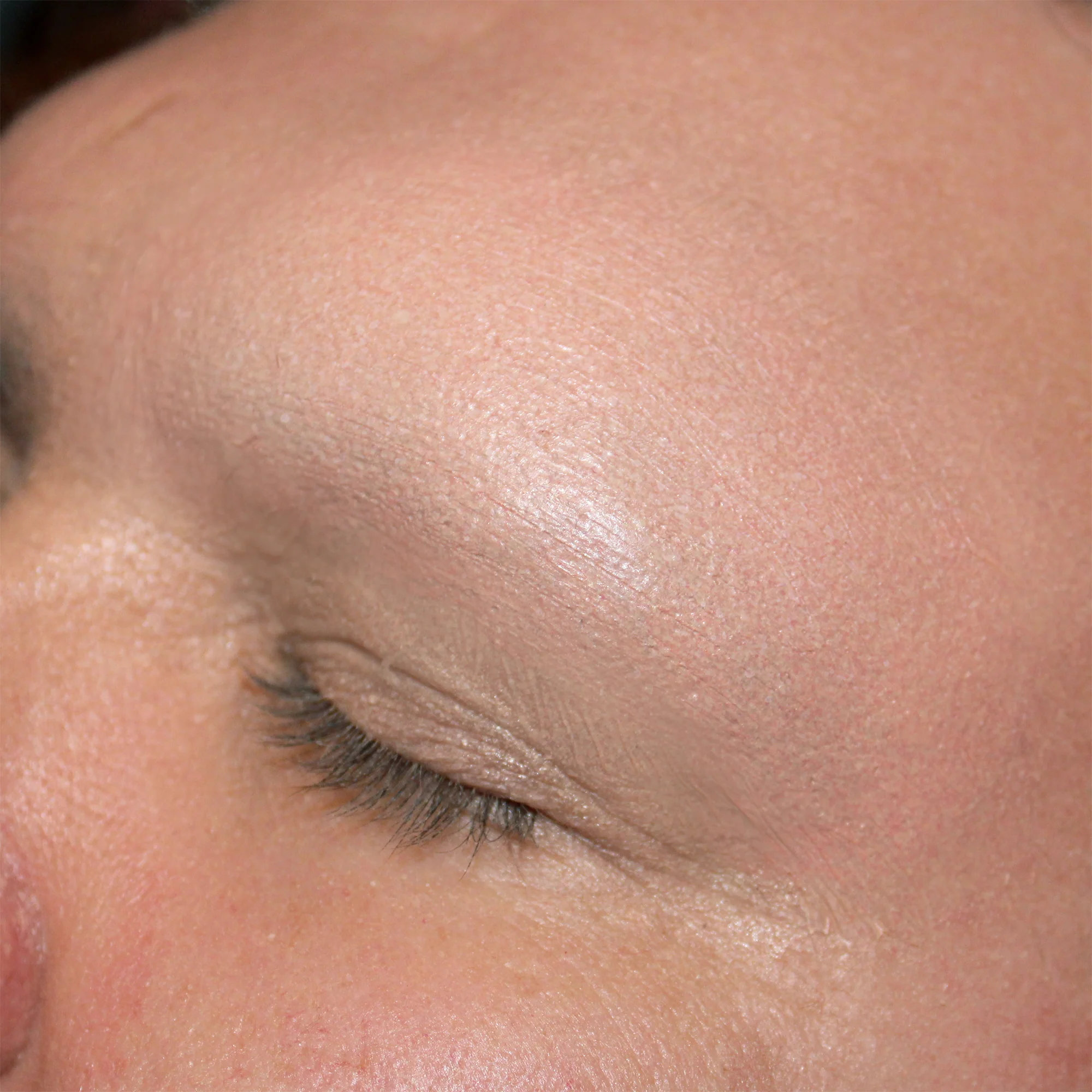 Jess FX Prosthetic Appliances - Large Brow Blockers