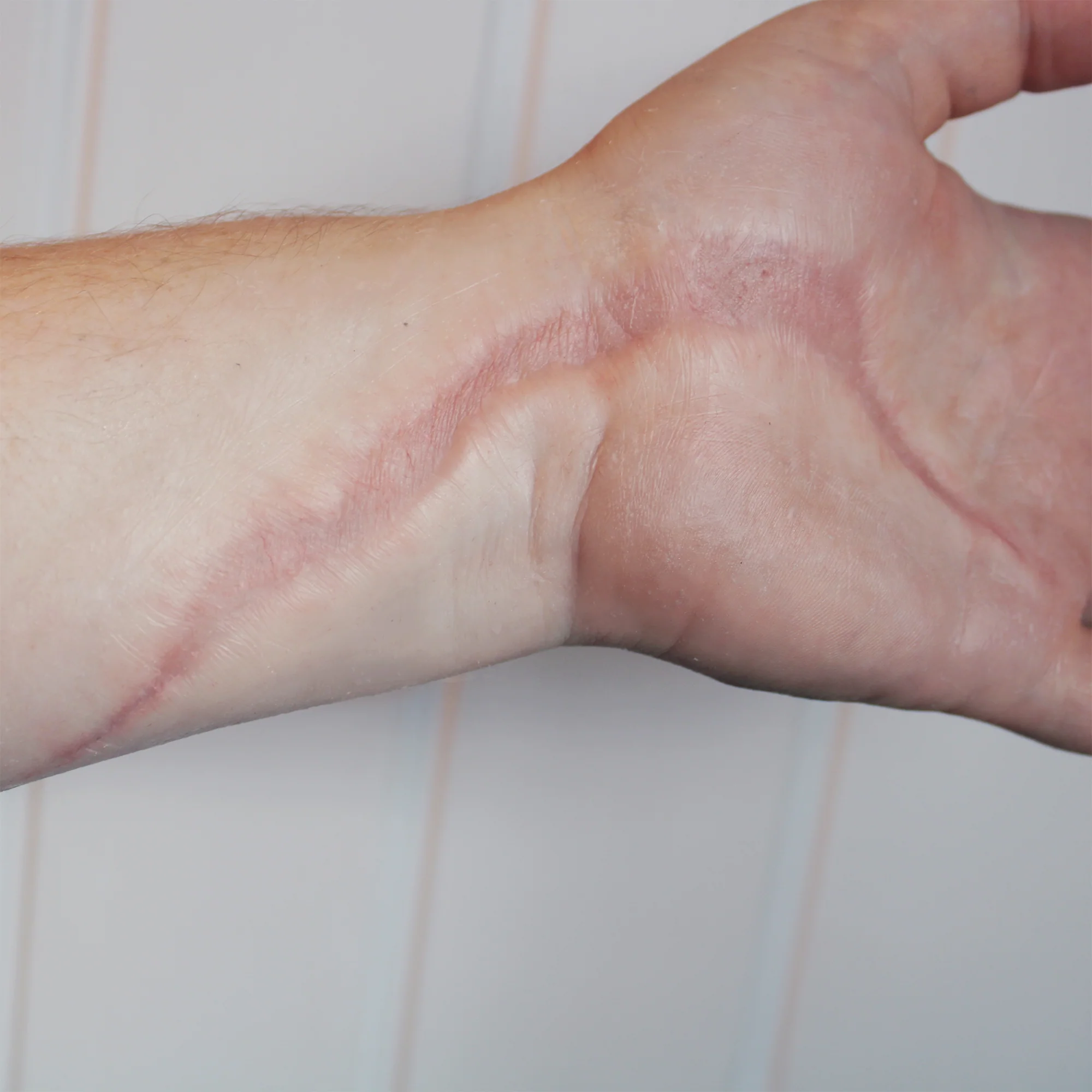 Jess FX Prosthetic Appliances - Large Scar