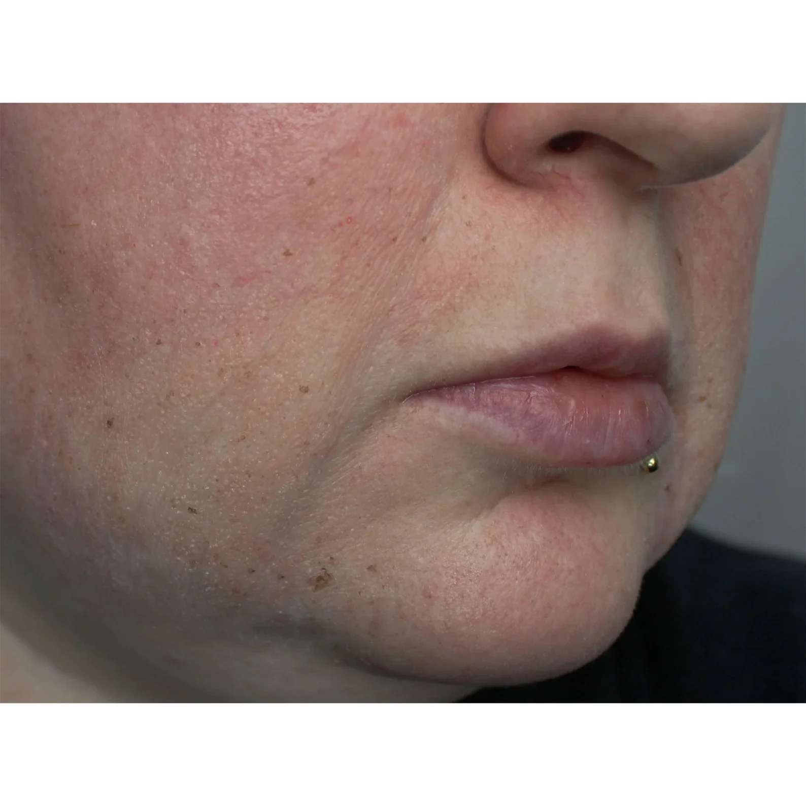Jess FX Prosthetic Appliances - Nasolabial Folds - Image 2