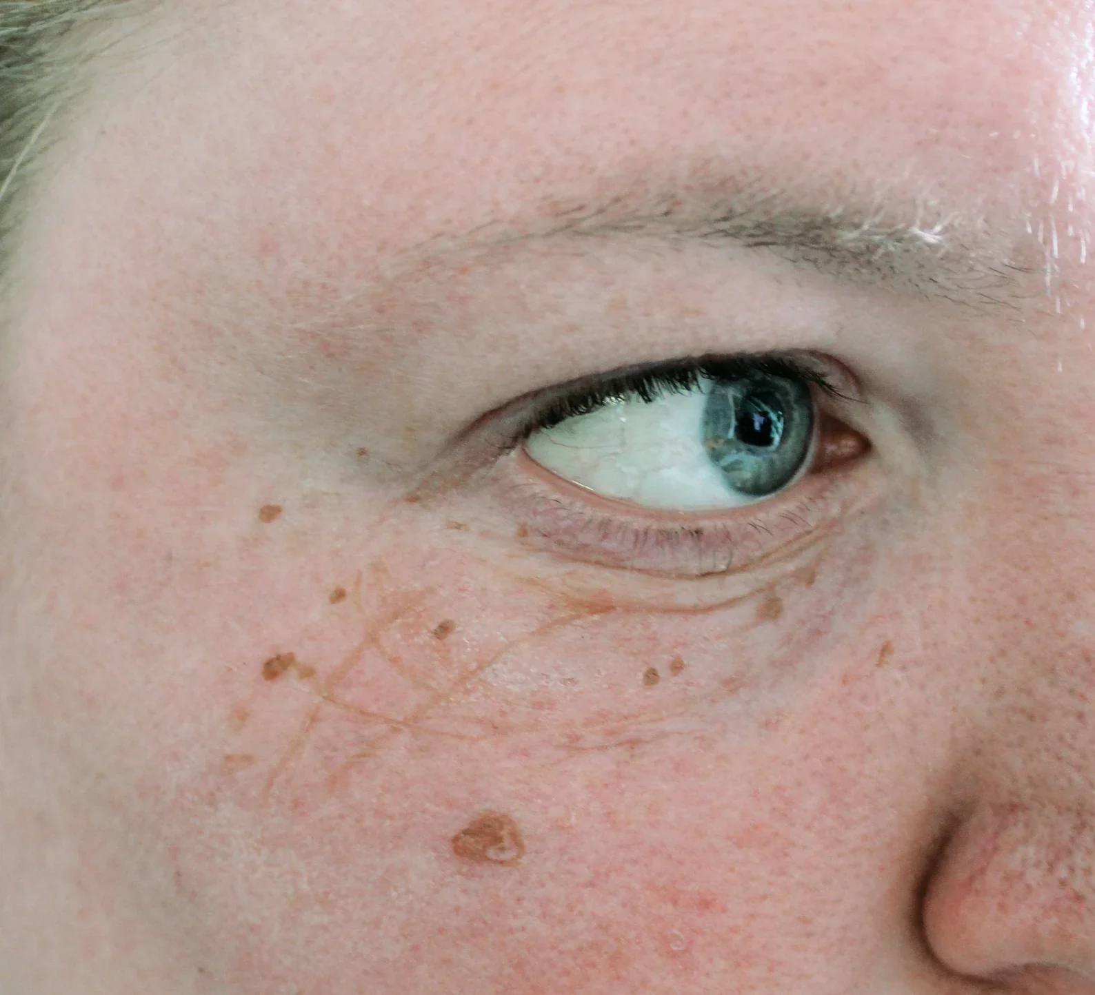 Jess FX Bondo Moulds - Old Age Eye Bags