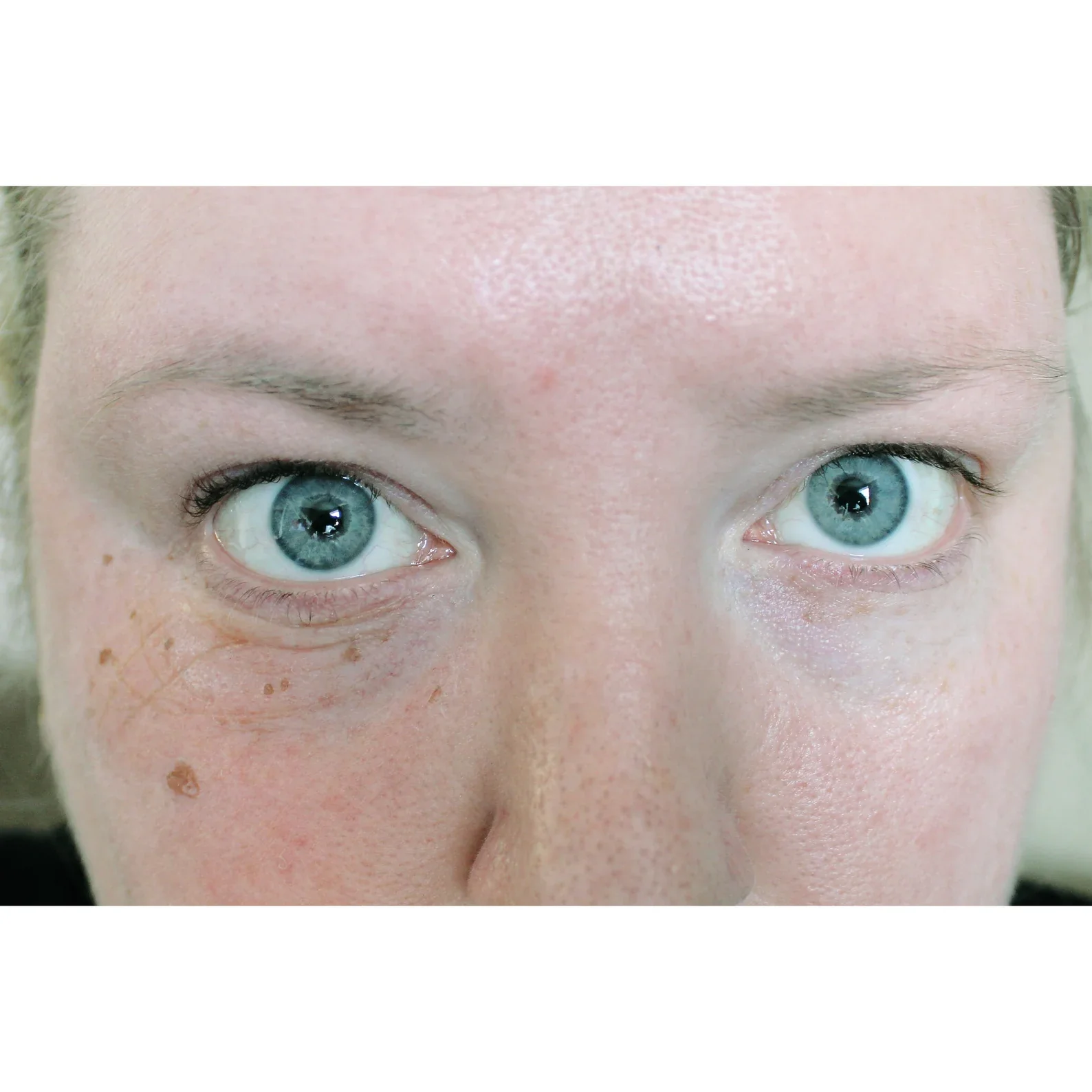 Jess FX Bondo Moulds - Old Age Eye Bags - Image 2
