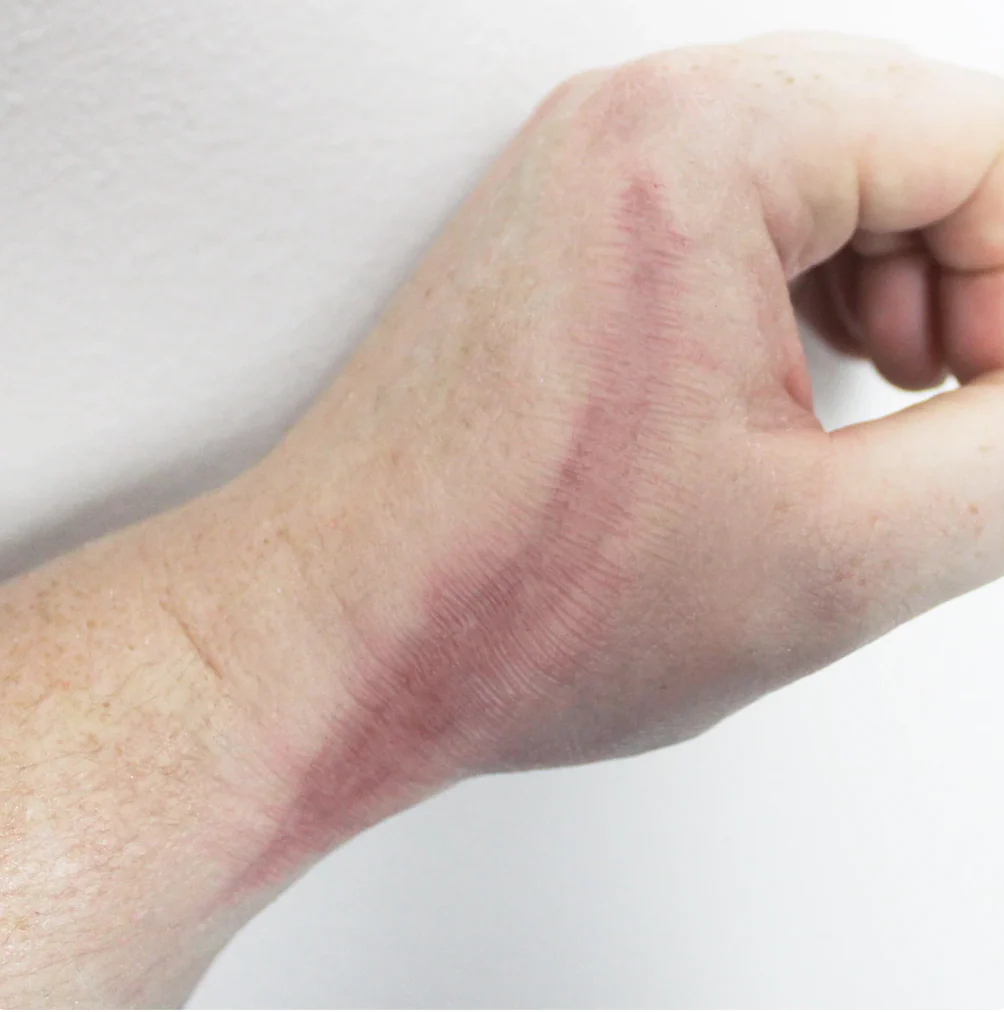 Jess FX Prosthetic Appliances - Medium Scar 1