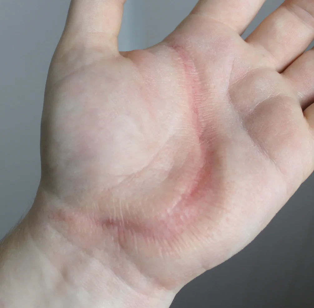Jess FX Prosthetic Appliances - Medium Scar 2