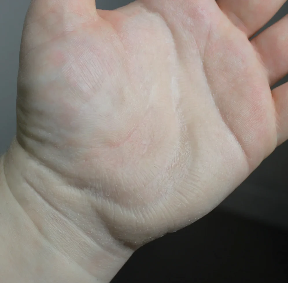 Jess FX Prosthetic Appliances - Medium Scar 2 - Image 2