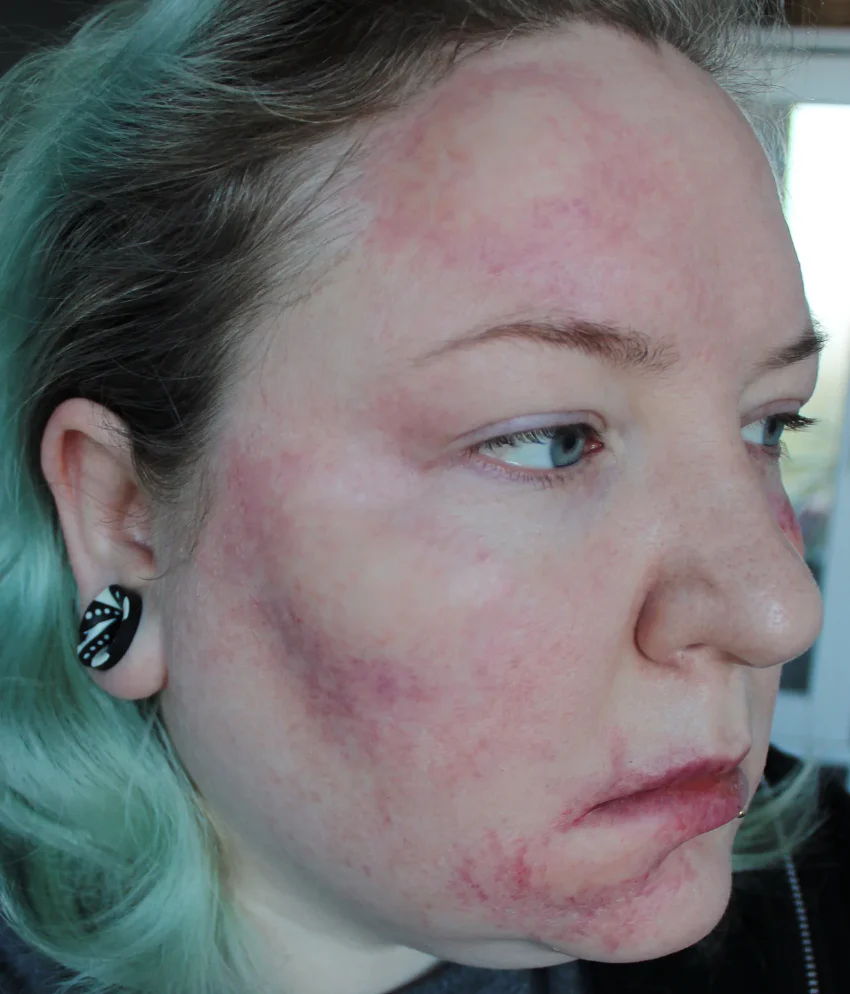 Jess FX Prosthetic Appliances - Swellings Medium