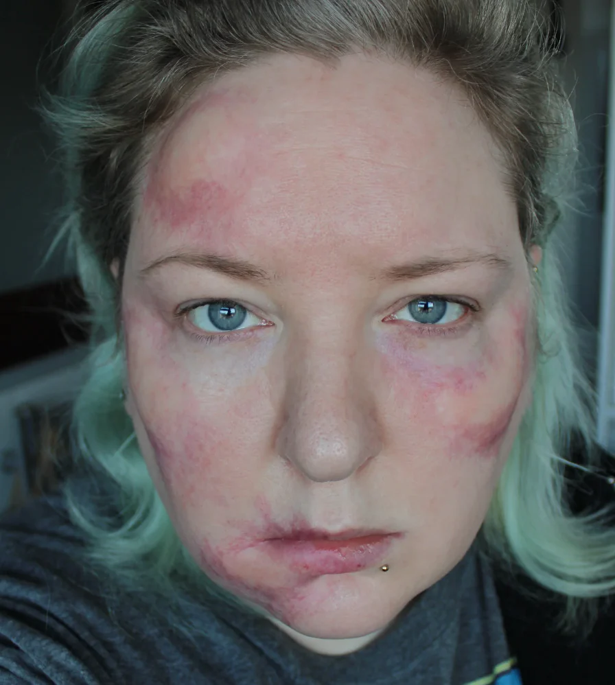 Jess FX Prosthetic Appliances - Swellings Medium - Image 2