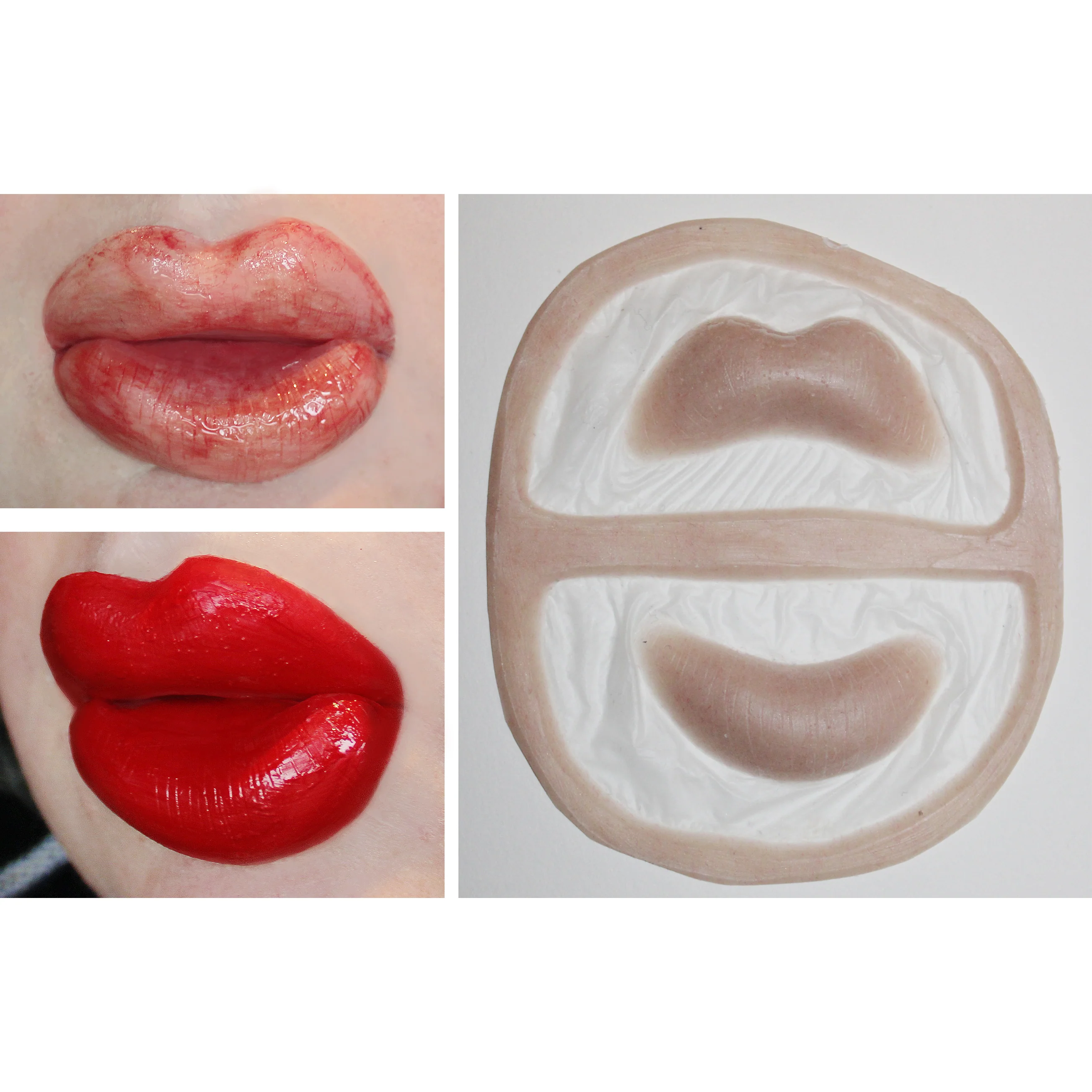 Jess FX Prosthetic Appliances - Botched/ Surgery Lips - Image 2