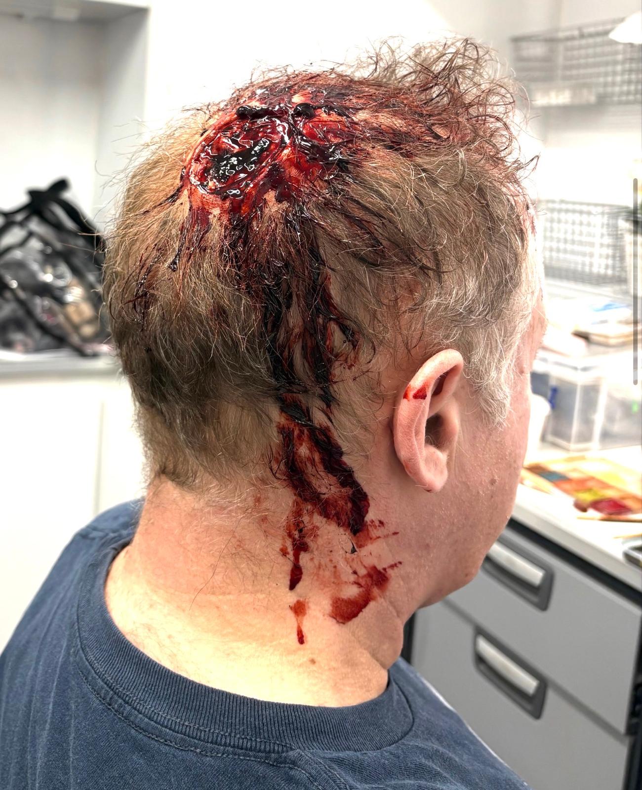 Out of Kit Casualty with Marie Deehan - 1 Day Course - Image 4