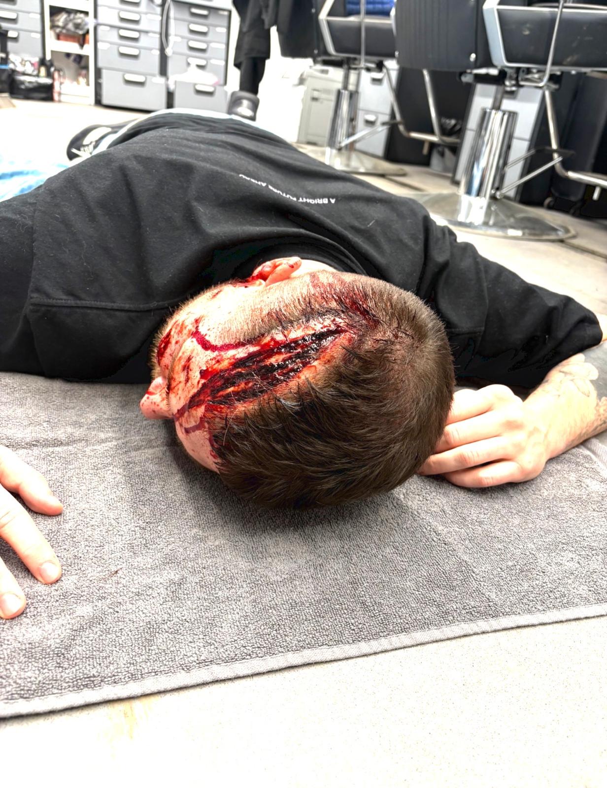 Out of Kit Casualty with Marie Deehan - 1 Day Course - Image 5