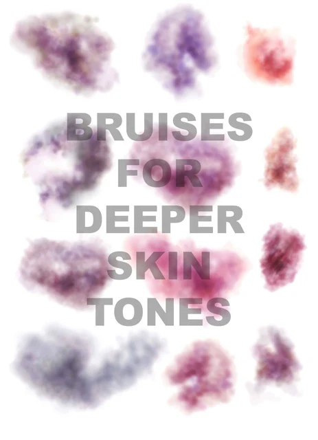 Mad Inc - Bruises for Darker Skintones