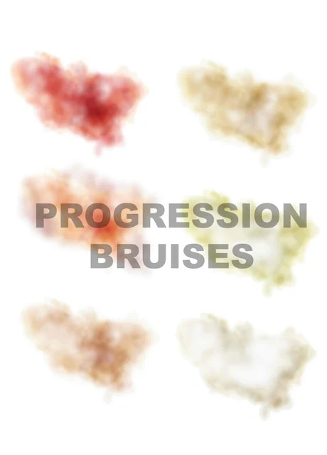 Mad Inc - Pam Really Useful Progression Bruises 3