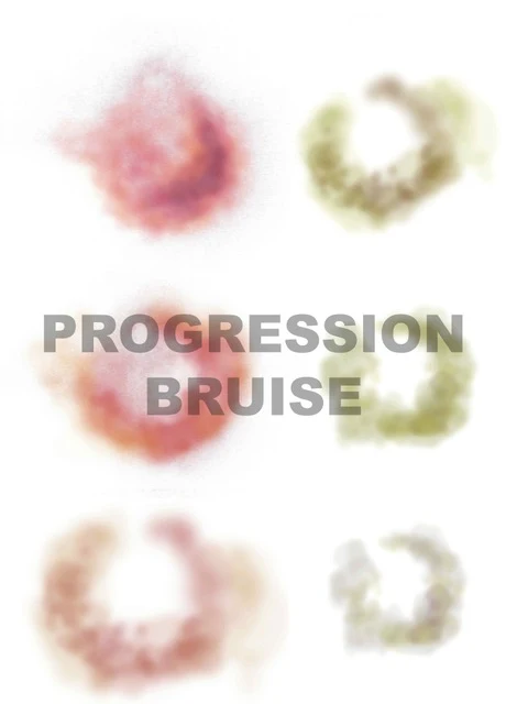 Mad Inc - Pam Really Useful Progression Bruises 2