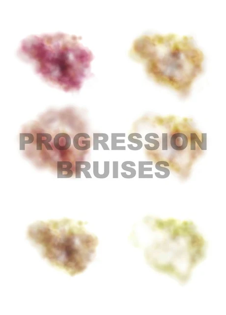 Mad Inc - Pam Really Useful Progression Bruises 1