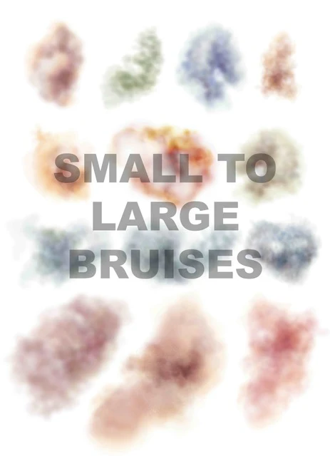 Mad Inc - Small to Large Bruises