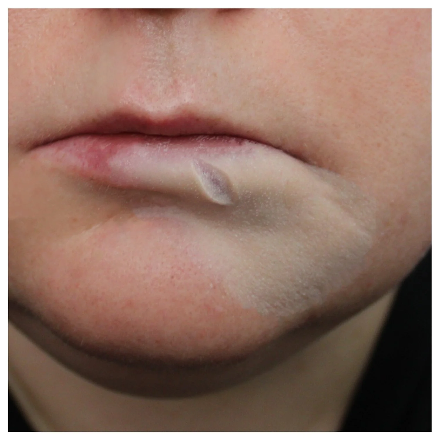 Jess FX Appliances -Swollen Split Lip